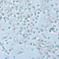 thumbnail for publication: Pasteuria penetrans (Bacilli: Bacillales: Pasteuriaceae)